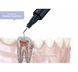 Dengocal LC, полімеризуючий світлом гідроксид кальцію, лайнер 2 г (Dengen Dental) ПМ-18 фото 2
