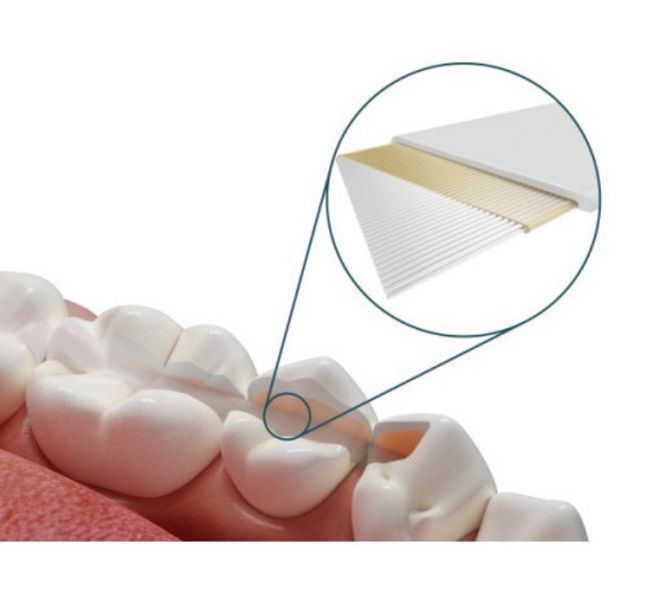 Dentapreg Splint, Дентапрег, Шинирувальна стрічка SFU, 50х2х0,2 мм ШЛ-3 фото