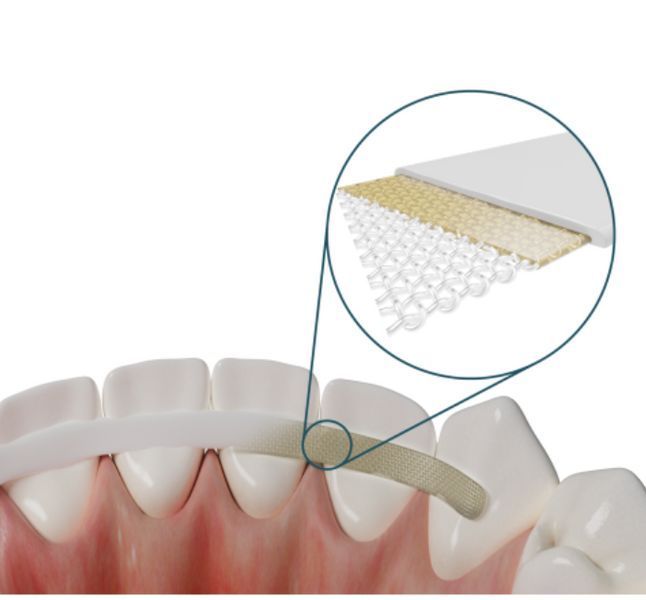 Dentapreg Splint, Дентапрег, Шинирувальна стрічка SFM, 50х2х0,2 мм ШЛ-2 фото
